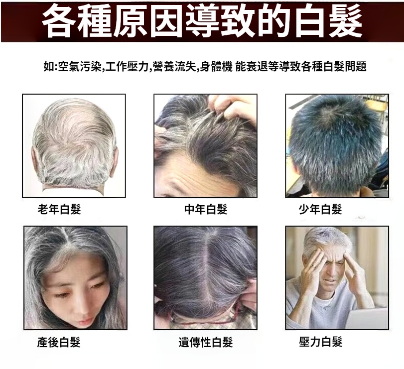 天然何首烏純植物黑髮洗髮精柔順順滑烏髮液少年中老年洗髮液